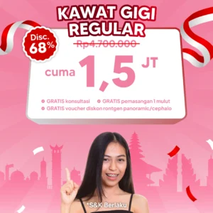 Promo Kawat Gigi Reguler 1,5jt