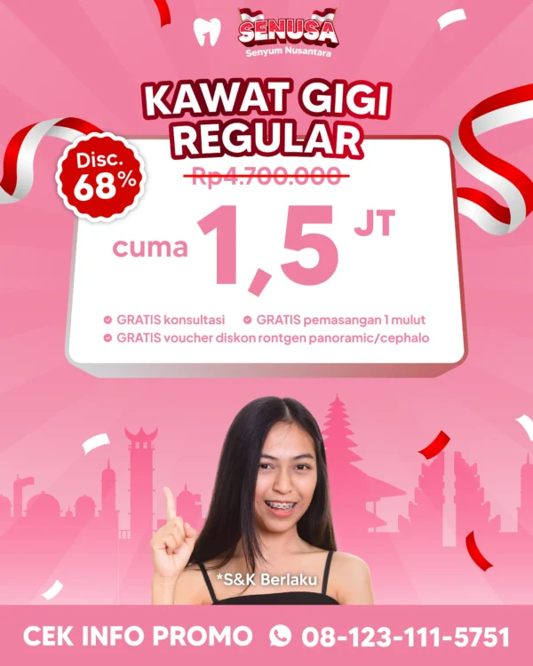 Promo Kawat Gigi Reguler 1,5jt