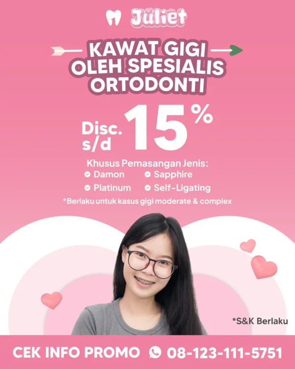 Promo Kawat Gigi Spesialis Ortodonti s/d 15%