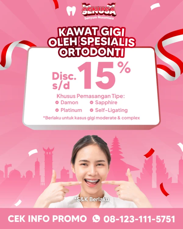 Promo Kawat Gigi Spesialis Ortodonti s/d 15%
