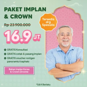 Promo Paket Implan & Crown