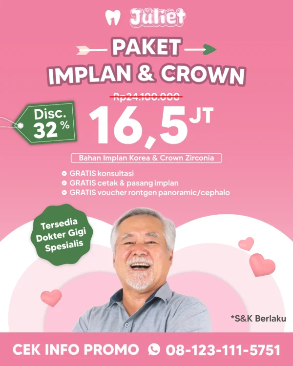 Promo Paket Implan & Crown