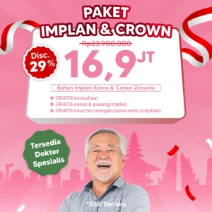 Promo Paket Implan & Crown
