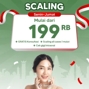 Promo Scaling Mulai Dari 199rb