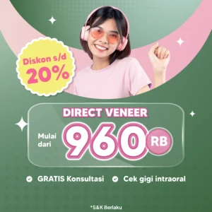 Promo Direct Veneer Mulai dari 960rb Surabaya