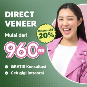 Promo Direct Veneer Mulai dari 960rb Surabaya