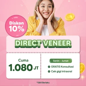 Promo Direct Veneer Surabaya