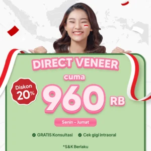 Promo Direct Veneer 20% Surabaya