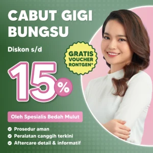 Promo Cabut Gigi Bungsu Diskon s/d 15% Surabaya