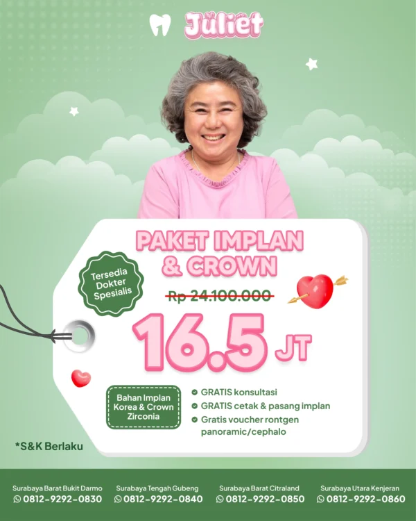 Promo Implant & Crown Surabaya