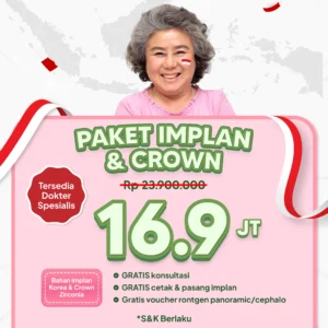 Promo Implant & Crown Surabaya