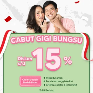 Promo Cabut Gigi Bungsu s/d 15% Surabaya