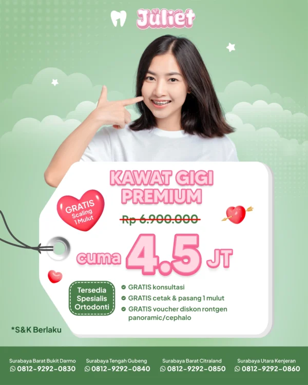 Promo Kawat Gigi Premium 4,5 Jt Surabaya