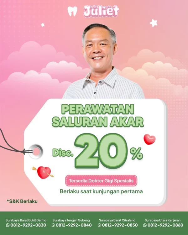 Promo Perawatan Saluran Akar 20% Surabaya