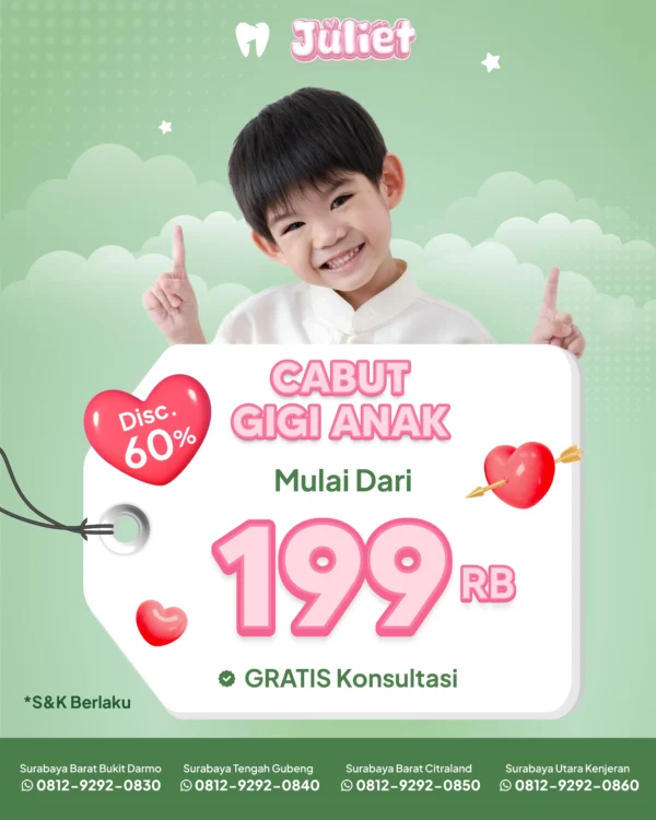 Promo Cabut Gigi Susu Anak 199rb Surabaya