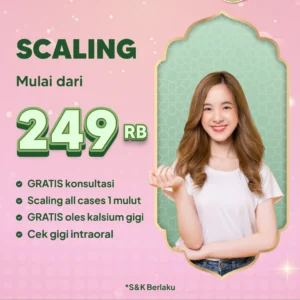 Promo Scaling Mulai Dari 249rb Surabaya
