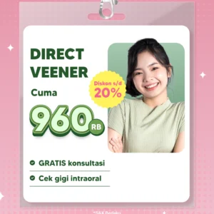 Promo Direct Veneer Semarang