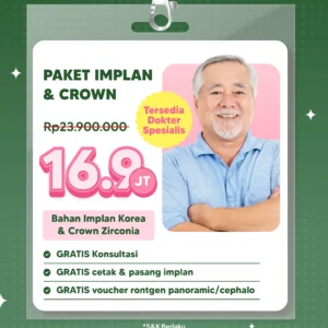 Promo Implant & Crown Semarang
