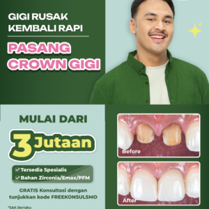 SMILE MAKEOVER Crown Gigi 3 Jutaan
