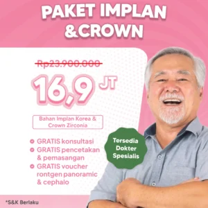 Promo Implant & Crown Semarang