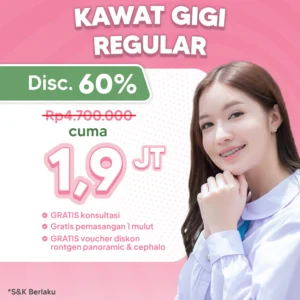 Promo Kawat Gigi Regular 1,9 Jt Semarang