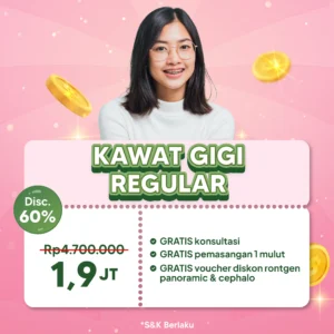 Promo Kawat Gigi Regular 1,9 Jt Semarang
