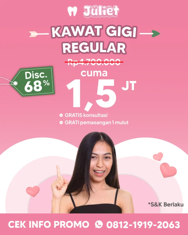 Promo Kawat Gigi Regular 1,5 Jt Semarang