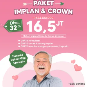 Promo Implant & Crown Semarang