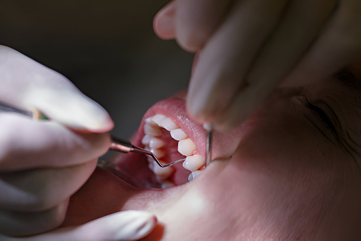 Peran Spesialis Periodonsia