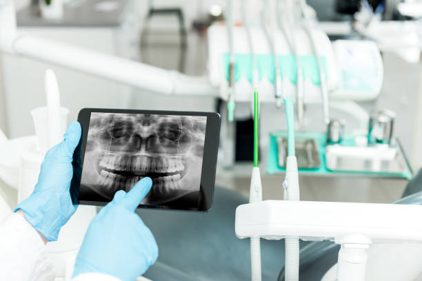 Pemeriksaan Radiografik (Rontgen Gigi)
