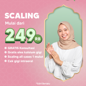 Promo Scaling Cuma 249rb