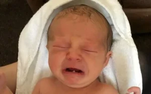 Bayi Baru Lahir Punya Gigi, Apakah Normal?