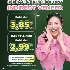 Promo Indirect Veneer