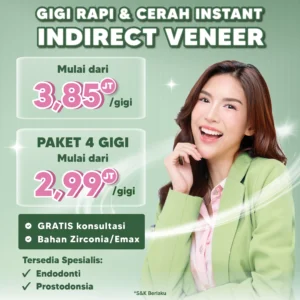 Promo Indirect Veneer