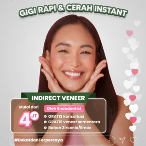 Promo Indirect Veneer