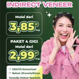 Promo Indirect Veneer