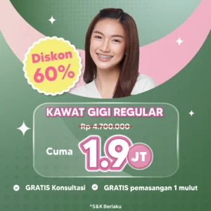 Promo Kawat Gigi Reguler Cuma 1,9jt Surabaya