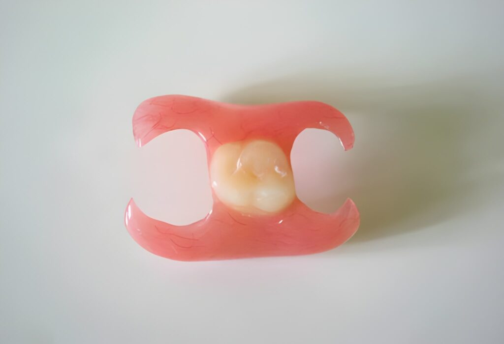 Immediate Denture: Solusi Gigi Palsu Langsung Pasang, Ini Penjelasannya