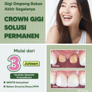 Promo Crown Gigi Mulai dari 3jtan