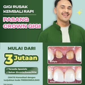 Promo Crown Gigi Mulai dari 3jtan
