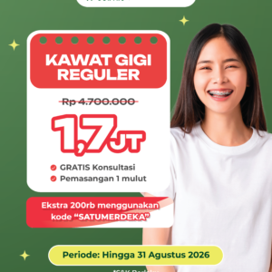 Promo Spesial Kawat Gigi Reguler SATU x Indodana