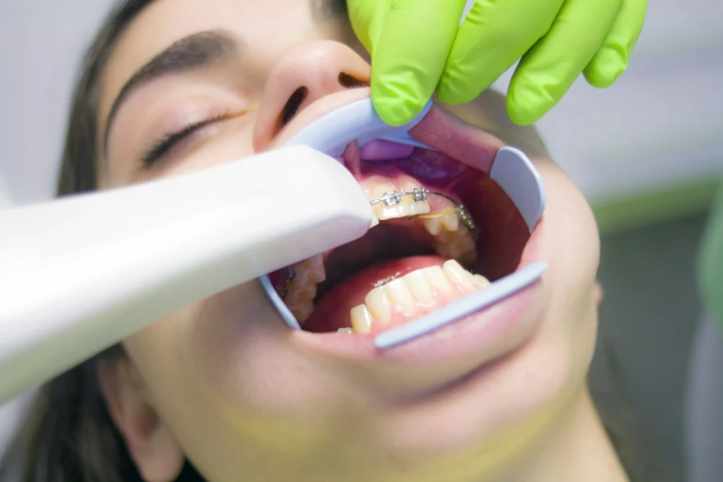 Faktor yang Memengaruhi Harga Pasang Behel Atas Bawah Klinik Gigi SATU Dental