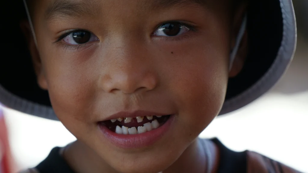 Jumlah Gigi pada Anak anak vs Dewasa Klinik Gigi SATU Dental
