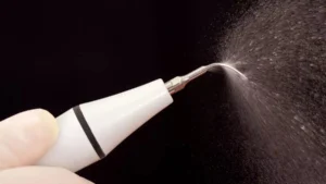 Pembersih Karang Gigi, Mulai Dari Baking Soda Hingga Scaling