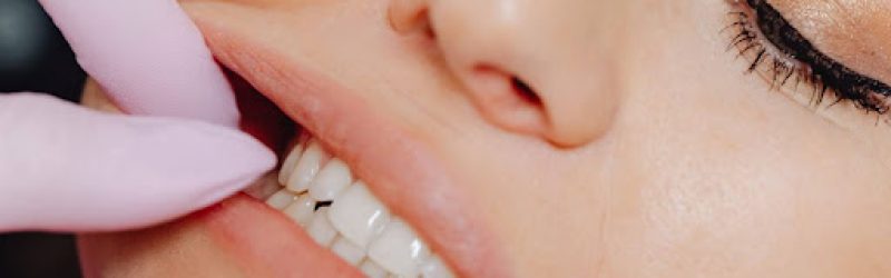 6 Kondisi Gigi yang Tidak Bisa Dibehel