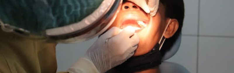 6 Penyebab Karang Gigi dan Cara Mencegahnya yang Efektif
