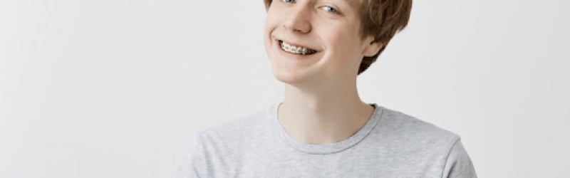 Apa Itu Self Ligating Braces? Harga dan Perbedaan dengan Conventional Braces