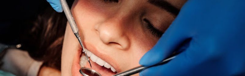 Biaya Perawatan Saluran Akar Gigi dan Manfaatnya