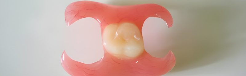 Immediate Denture Solusi Gigi Palsu Langsung Pasang, Ini Penjelasannya