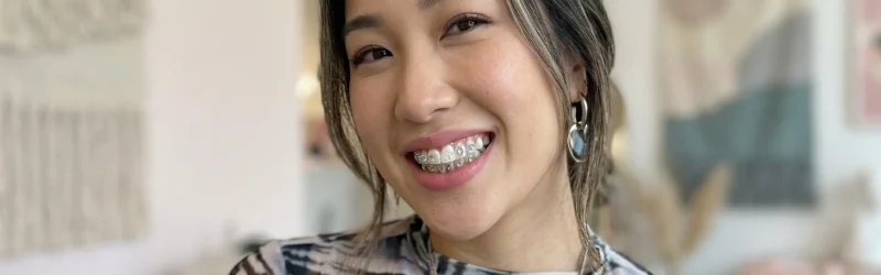 Ketahui Tooth Gem, Hiasan Gigi Centil ala Naykilla!